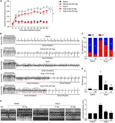 Gallic Acid Ameliorates Angiotensin II-Induced Atrial Fibrillation by Inhibiting Immunoproteasome- Mediated PTEN Degradation in Mice